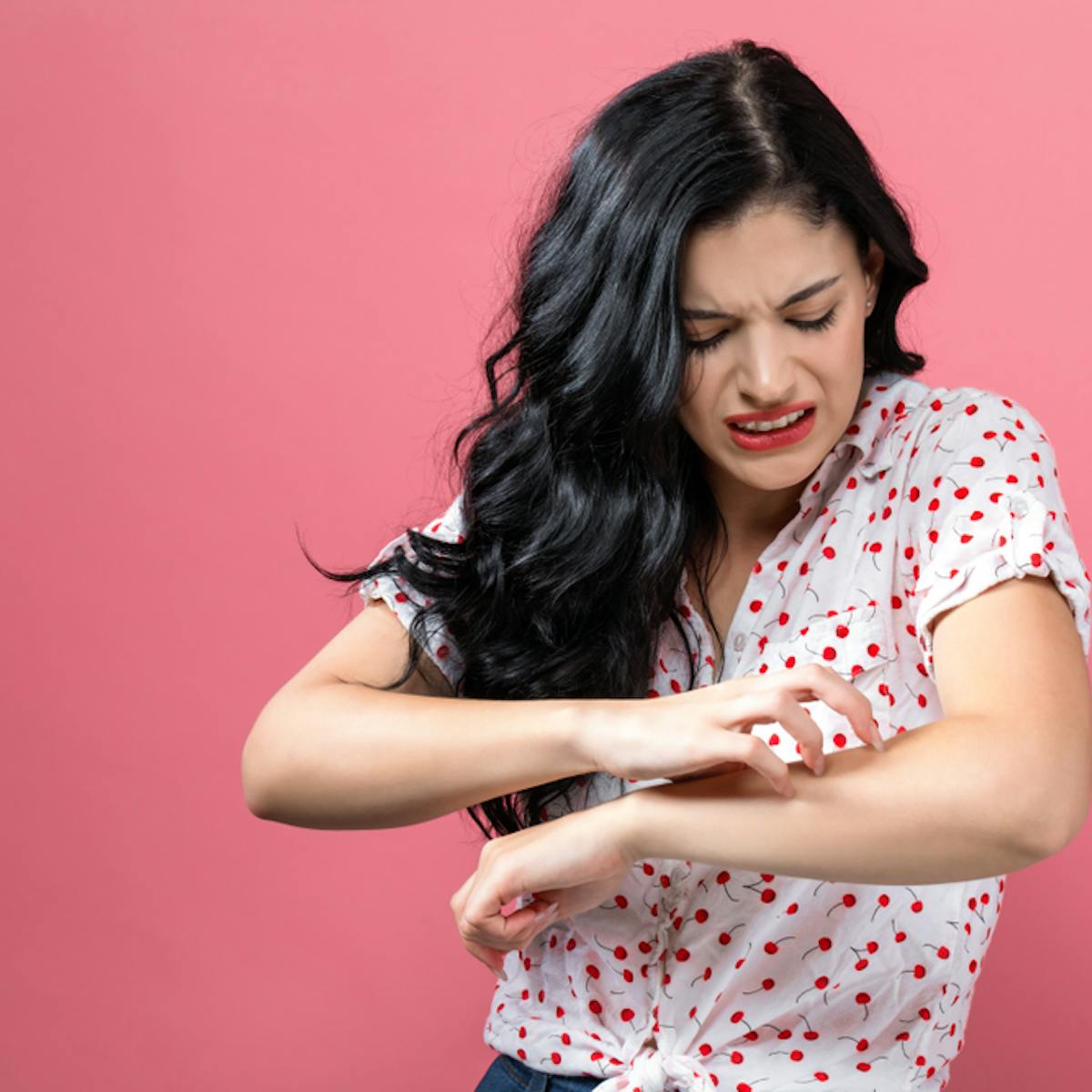 What Are Hives The Common Skin Condition That Gives You Itchy Red Bumps