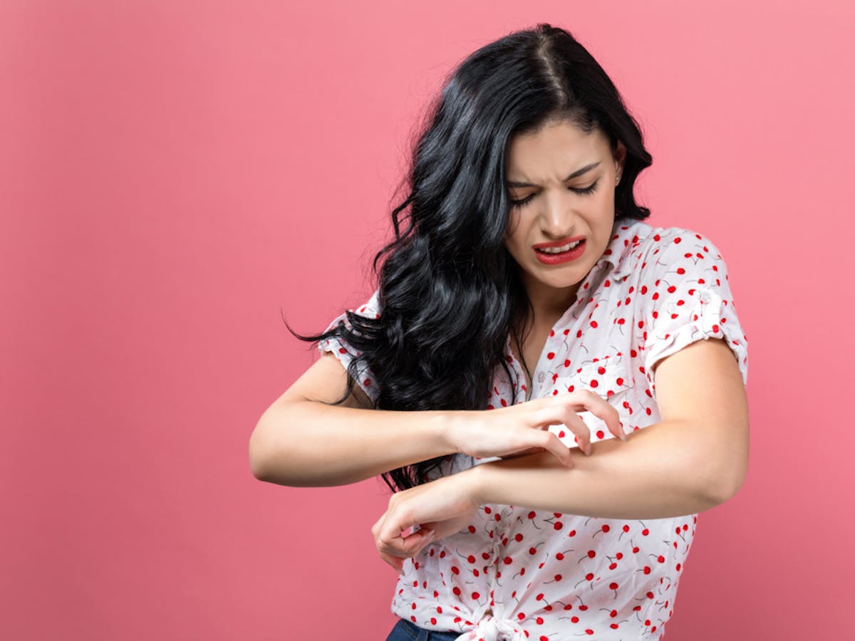 What Are Hives The Common Skin Condition That Gives You Itchy Red Bumps