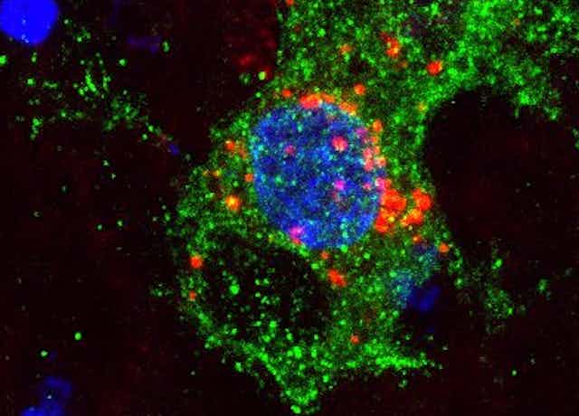 Quantum dots that light up TVs could be used for brain research