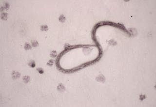 Six Human Parasites You Definitely Don T Want To Host Six Human Parasites You Definitely Don T Want To Host