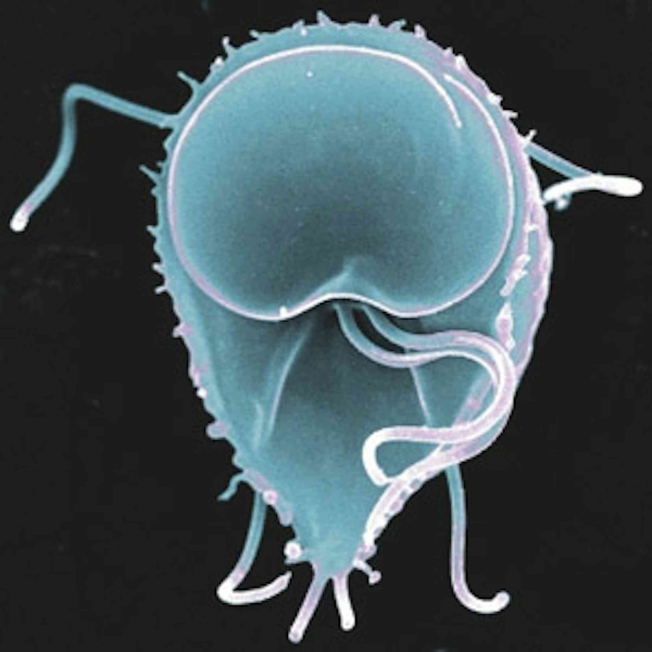 Six human parasites you definitely don't want to host