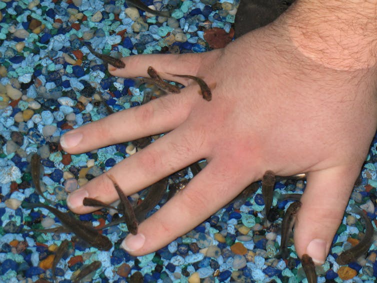 Six Human Parasites You Definitely Don T Want To Host