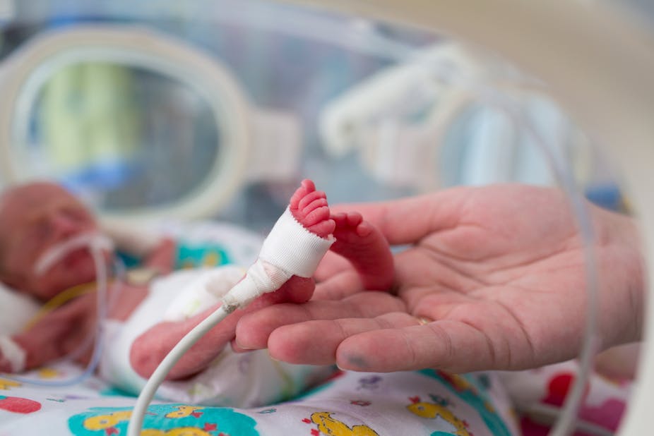 Lifesaving Treatment For Babies Born At 22 Weeks Doesn T Mean Abortion Law Should Change Lifesaving Treatment For Babies Born At 22 Weeks Doesn T Mean Abortion Law Should Change