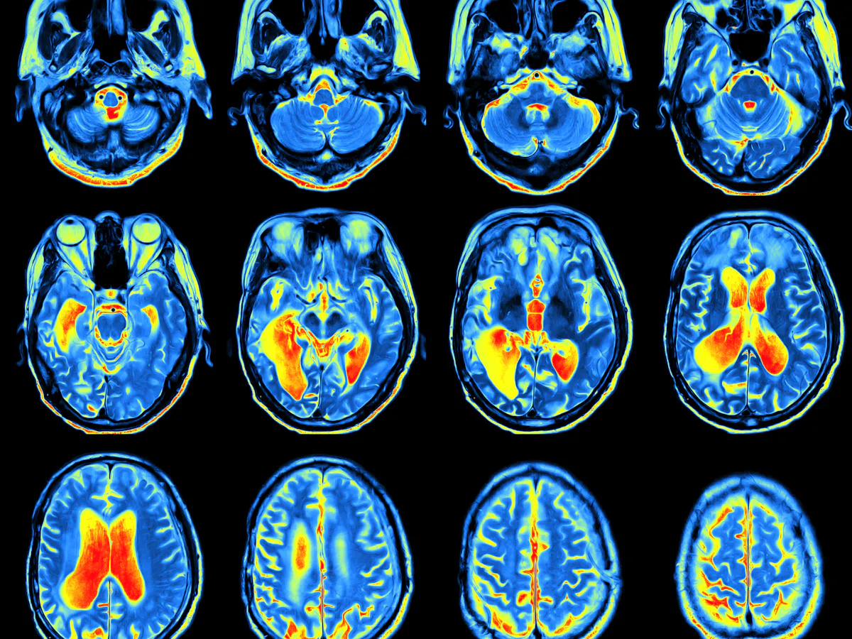Science As We Know It Can T Explain Consciousness But A Revolution Is Coming