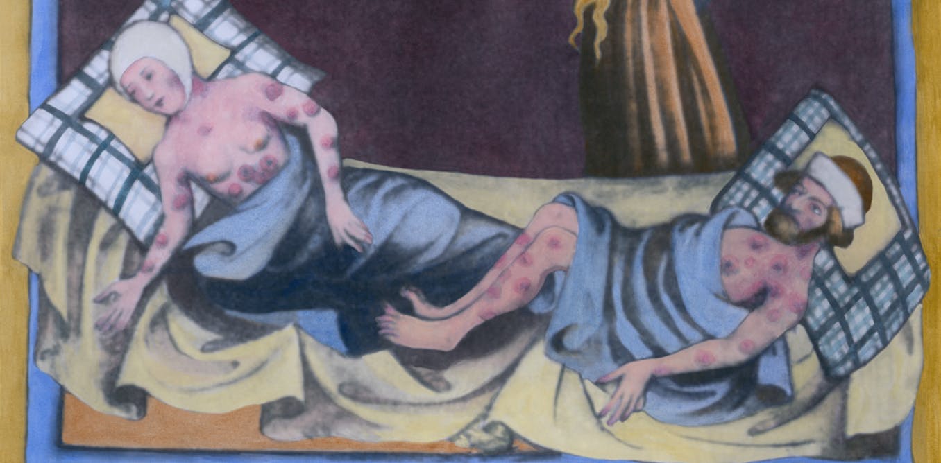 Plague was around for millennia before epidemics took hold – and the way people lived might be what protected them