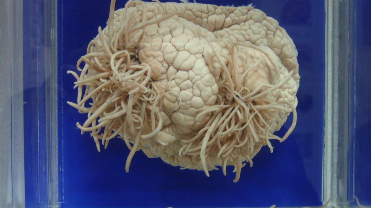 Brain-eating' parasites are winners in the warming world Brain-eating' parasites are winners in the warming world