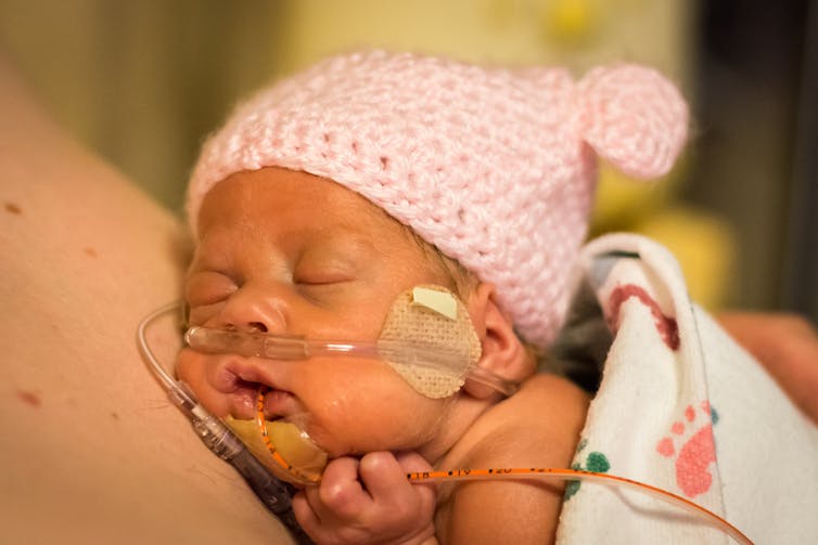 Stock photo of newborn baby in a hat, with breathing tubes in their nose and mouth