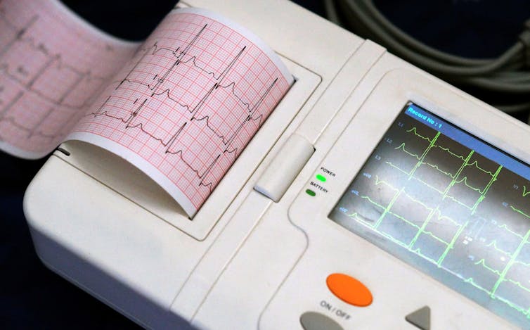 Medical AI can now predict survival rates – but it’s not ready to unleash on patients 1 Medical AI can now predict survival rates – but it’s not ready to unleash on patients Engineering News