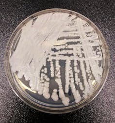 Why the CDC warns antibiotic-resistant fungal infections are an urgent health threat
