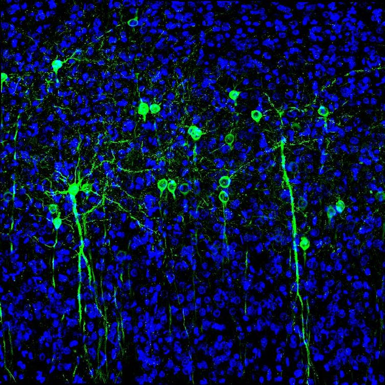 Brain activity predicts which mice will become compulsive drinkers