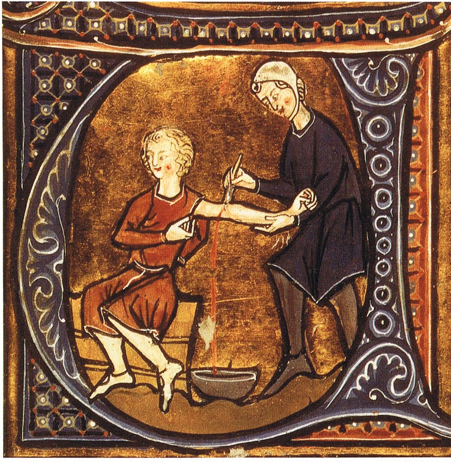 Медицина в средневековье кровопускание