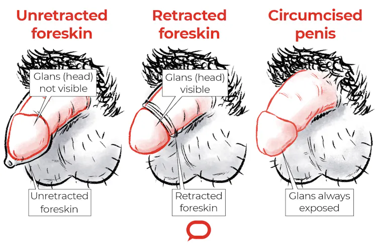 How do I clean my penis?' How do I clean my penis?'