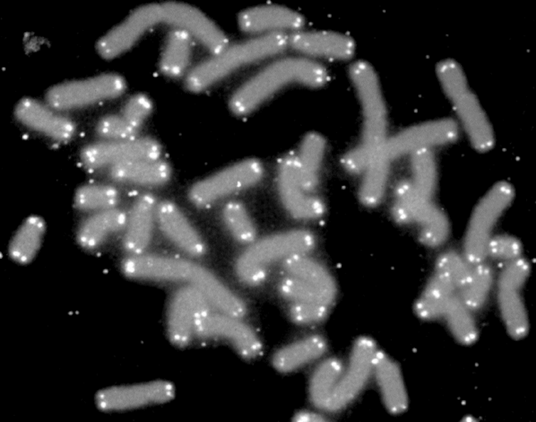 Tick, tock... how stress speeds up your chromosomes' ageing clock