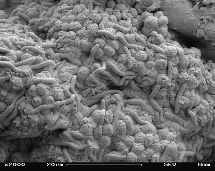 Mars Microbe Life on Mars? Europe commits to groundbreaking mission to bring back ...