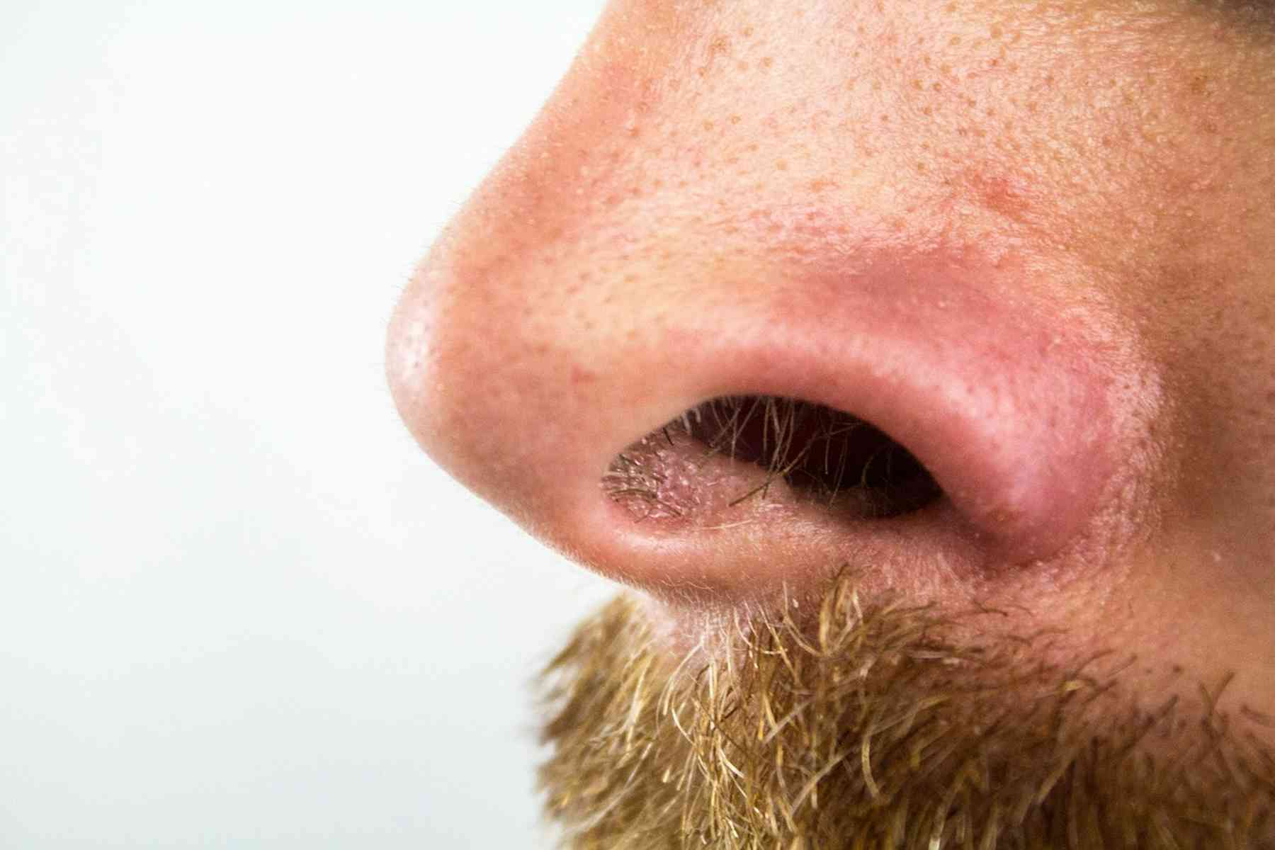 Hidung manusia 