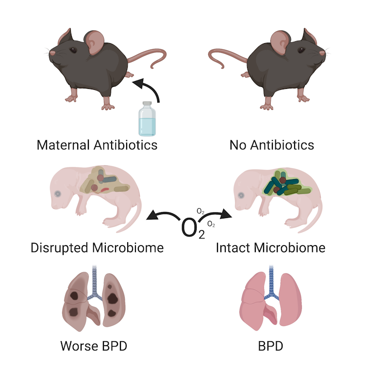 Giving pregnant women antibiotics could harm the lungs of preemies, according to study in mice