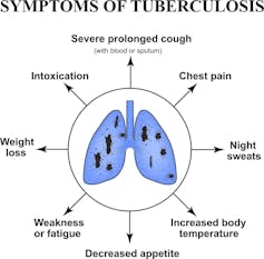 A new way to give an old TB vaccine proves highly effective in monkeys