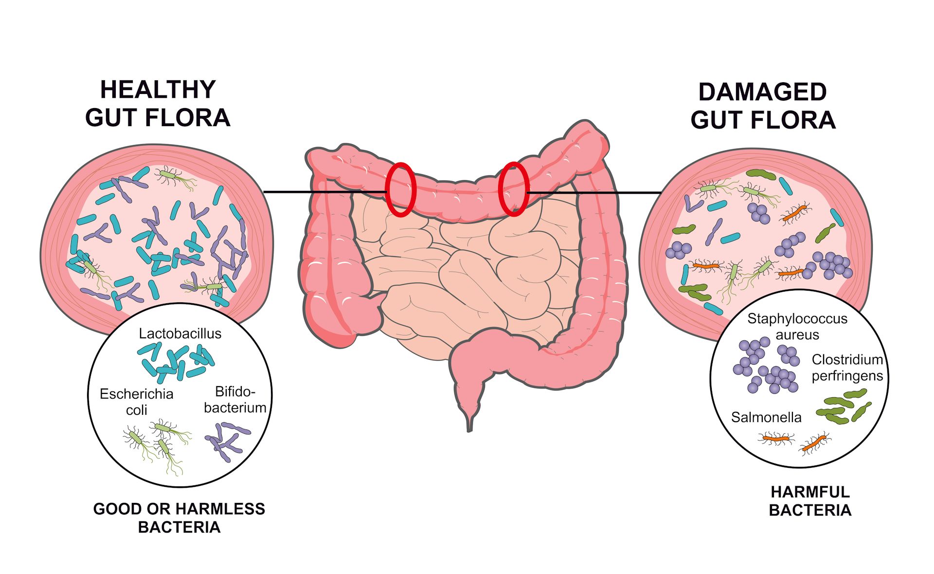 Progressive Charlestown: 5 Things You Can Do To Make Your Microbiome ...