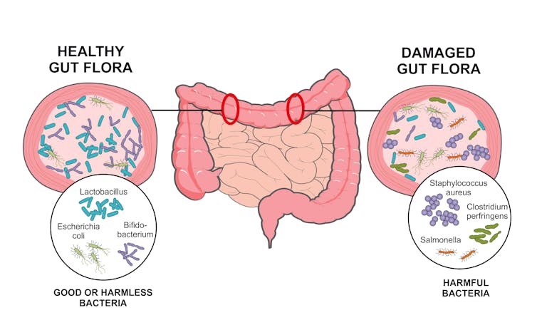 5 things you can do to make your microbiome healthier