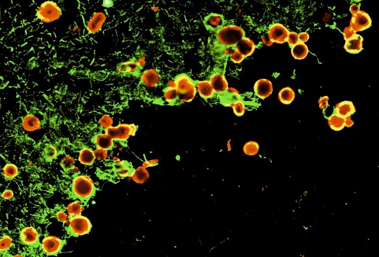 Cómo se limpia el cerebro