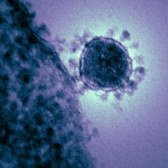 The electron microscopic image, reveals the crown shape structural details for which the coronavirus was named. This image is of the Middle East respiratory syndrome coronavirus (MERS-CoV).