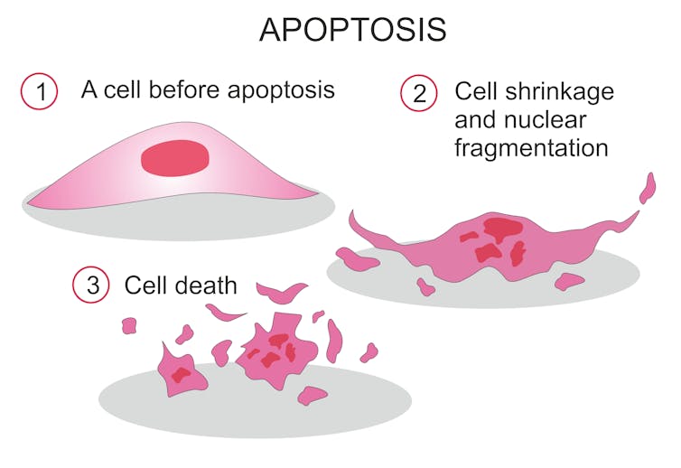 Anthrax vs. cancer – researchers harness the deadly toxin to cure dogs and hopefully people