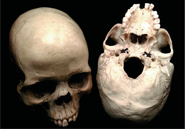 How smart were our ancestors? Turns out the answer isn't in brain size, but blood flow