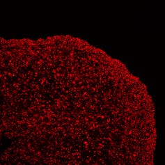 Brain organoids help neuroscientists understand brain development, but aren't perfect matches for real brains