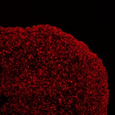 Brain organoids help neuroscientists understand brain development, but aren't perfect matches for real brains