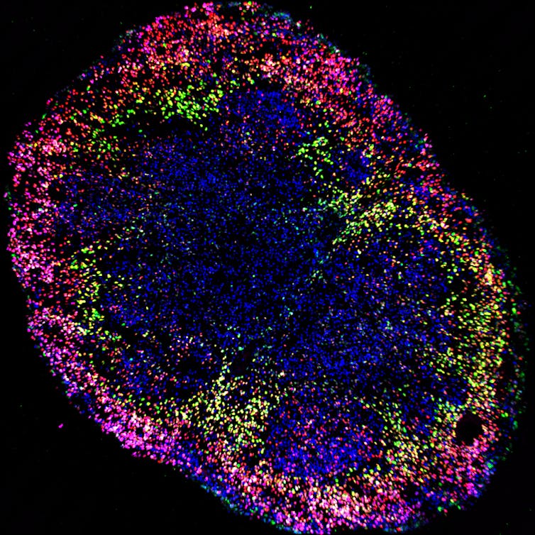 Brain organoids help neuroscientists understand brain development, but aren't perfect matches for real brains