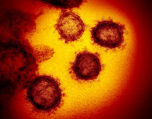 Covid 19 Jadi Pandemi Bagaimana Virus Ini Bekerja Melumpuhkan Penderita Dan Prospek Uji Coba Obat Covid 19 Jadi Pandemi Bagaimana Virus Ini Bekerja Melumpuhkan Penderita Dan Prospek Uji Coba Obat