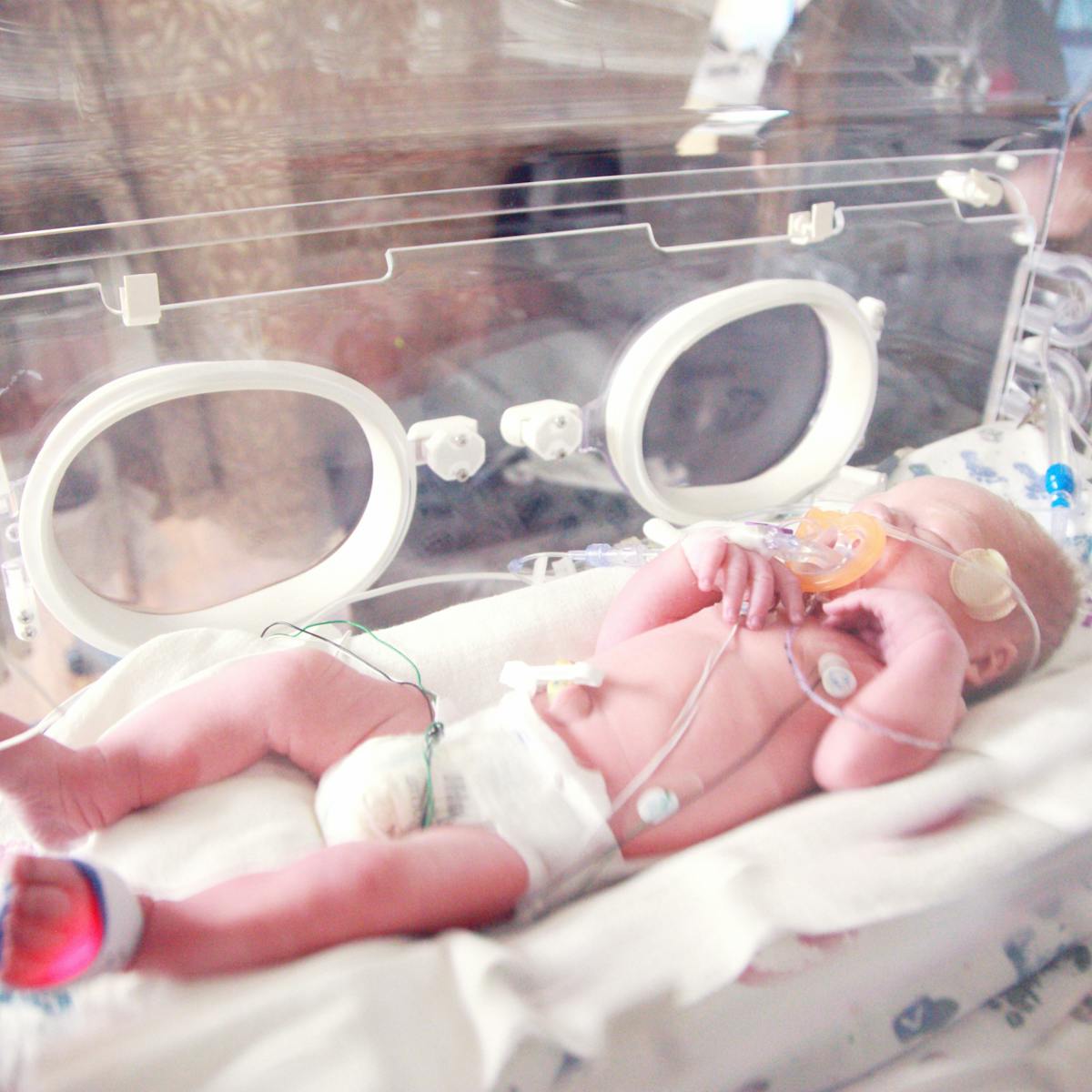 Nacimiento Prematuro Que Consecuencias Tiene En La Edad Adulta Nacimiento Prematuro Que Consecuencias Tiene En La Edad Adulta