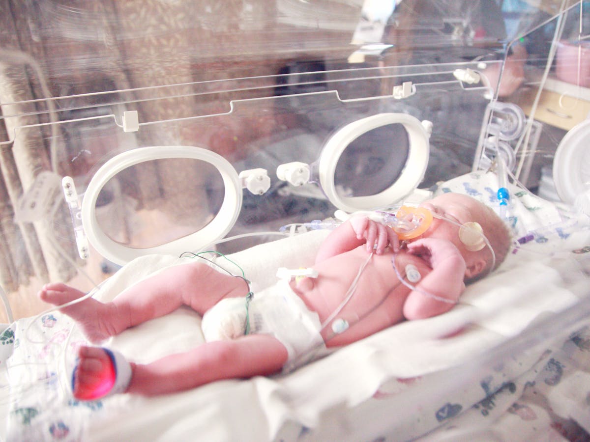 Nacimiento Prematuro Que Consecuencias Tiene En La Edad Adulta Nacimiento Prematuro Que Consecuencias Tiene En La Edad Adulta