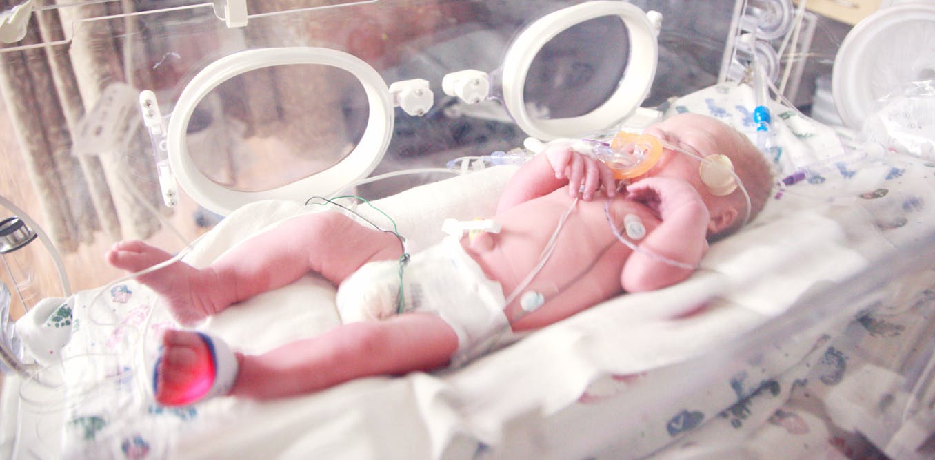 Nacimiento Prematuro Que Consecuencias Tiene En La Edad Adulta Nacimiento Prematuro Que Consecuencias Tiene En La Edad Adulta