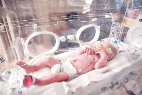 Nacimiento Prematuro Que Consecuencias Tiene En La Edad Adulta Nacimiento Prematuro Que Consecuencias Tiene En La Edad Adulta