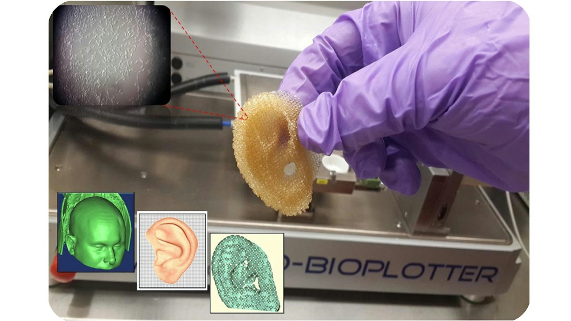 3Dprinted organs could save lives by addressing the transplant shortage