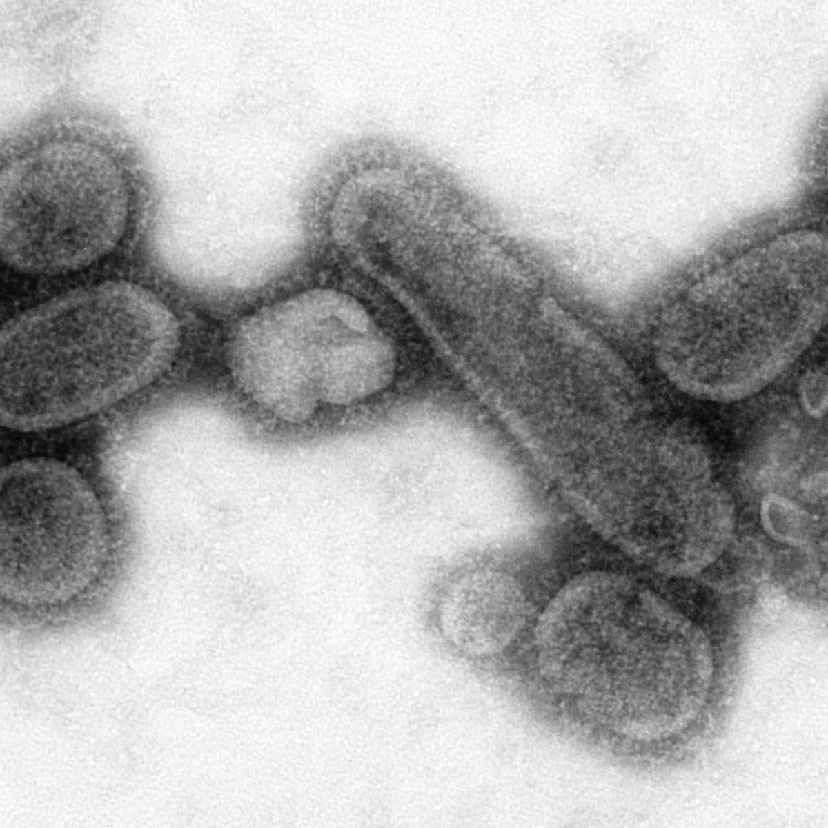 El virus que surgió del frío El virus que surgió del frío