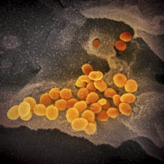 An electron microscope image for the SARS-CoV-2 virus (in orange) emerging from a cell (grey) that had been cultured in the lab. 