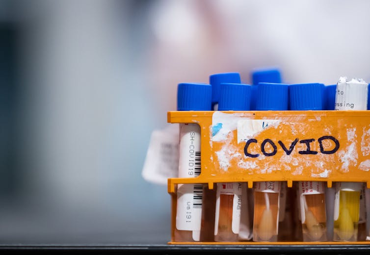Specimens await testing for COVID-19 at LifeLabs in Surrey, B.C.