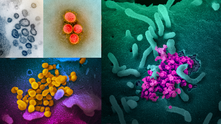 Scary red or icky green? We can't say what colour coronavirus is and dressing it up might feed fears