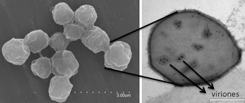 Los virus, esos grandes desconocidos para la mayoría de la sociedad, han adquirido una extraordinaria relevancia y una muy mala reputación en apenas unos días. No obstante, estos microorganismos juegan un papel esencial en los procesos evolutivos que han permitido la vida tal y como la conocemos.