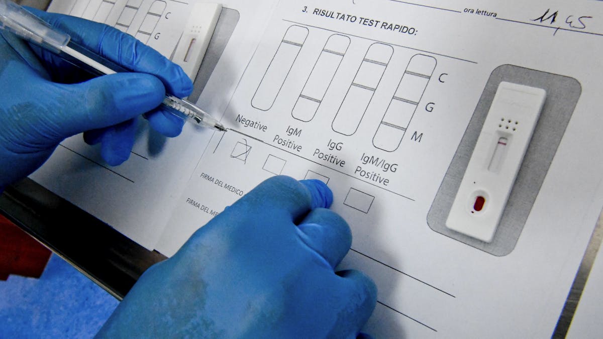 Mengapa Tes Cepat Rdt Coronavirus Bisa Negatif Palsu Sedangkan Tes Pcr Butuh 3 Hari Ini Cara Kerja Cerdas 2 Alat Deteksi Covid 19
