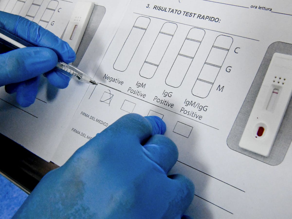 Mengapa Tes Cepat Rdt Coronavirus Bisa Negatif Palsu Sedangkan Tes Pcr Butuh 3 Hari Ini Cara Kerja Cerdas 2 Alat Deteksi Covid 19