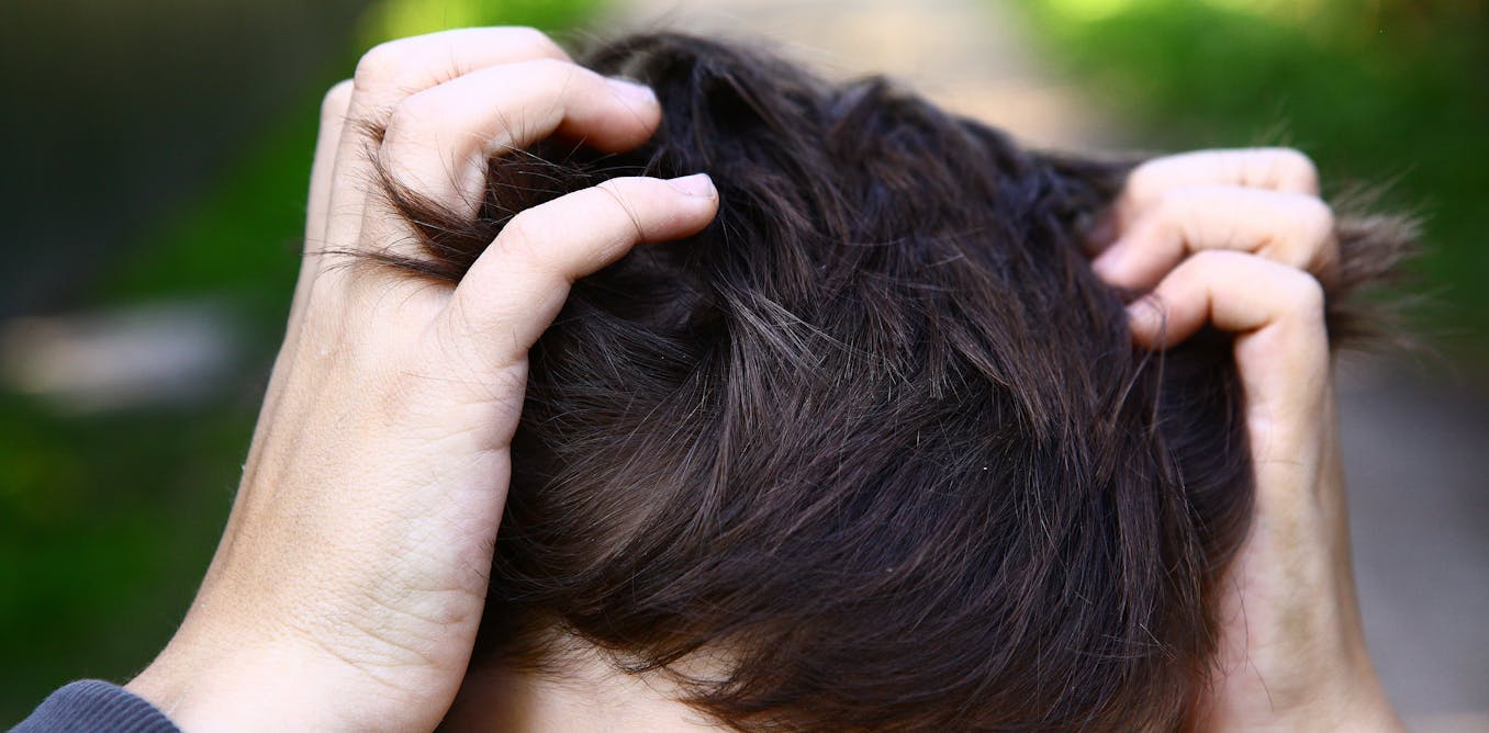 price of ivermectin in canada