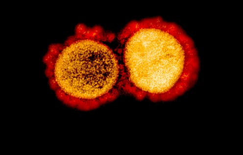 La Covid-19 está resultando un evento catastrófico global que está poniendo en jaque nuestra forma actual de vida. No obstante, conocemos al SARS-CoV-2 bastante mejor que los atenienses o los europeos del medioevo cuando se enfrentaron a la plaga de Atenas y la peste negra.