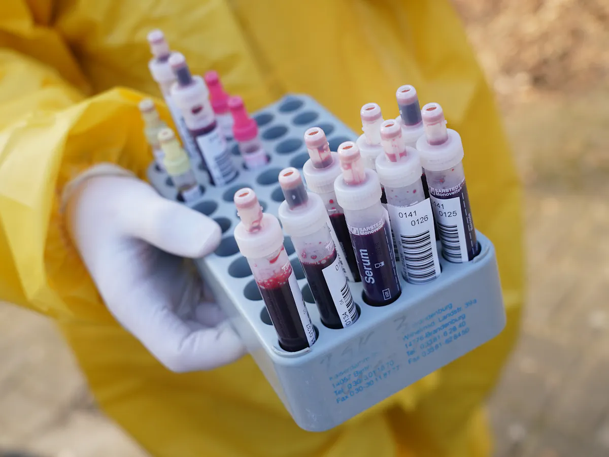 Checking Blood For Coronavirus Antibodies 3 Questions Answered About Serological Tests And Immunity