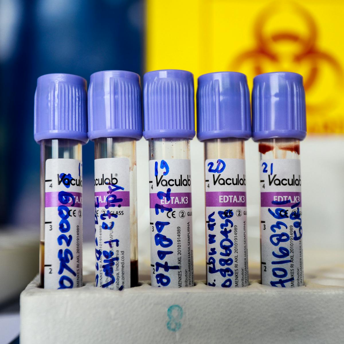 Poor And Rich Indonesians Do Not Get Equal Access To Covid 19 Tests This Is Why It S A Problem