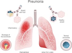 What does 'survival of the fittest' mean in the coronavirus pandemic? Look to the immune system