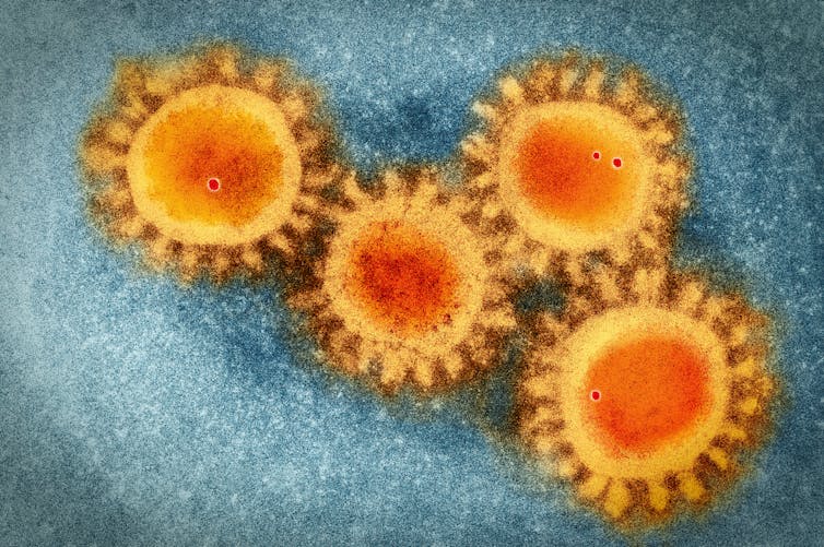 The coronavirus attacks human cells using dozens of devious tricks. narvikk/iStock Getty Images Plus via Getty Images
