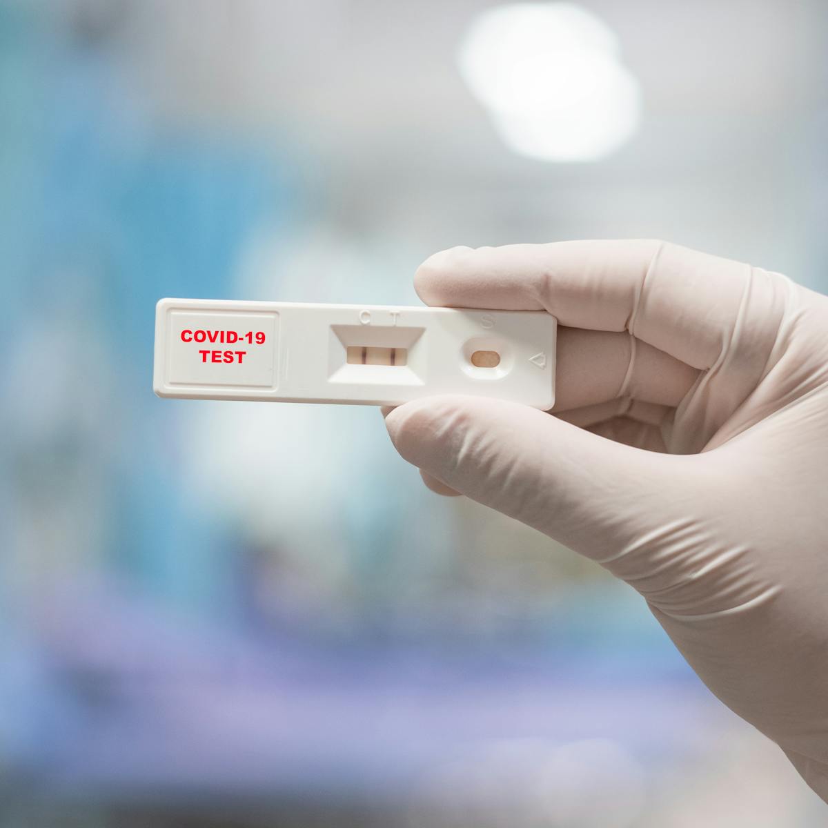Using Prenatal Blood Samples To Evaluate Covid 19 Rapid Serologic Tests Specificity Springerlink
